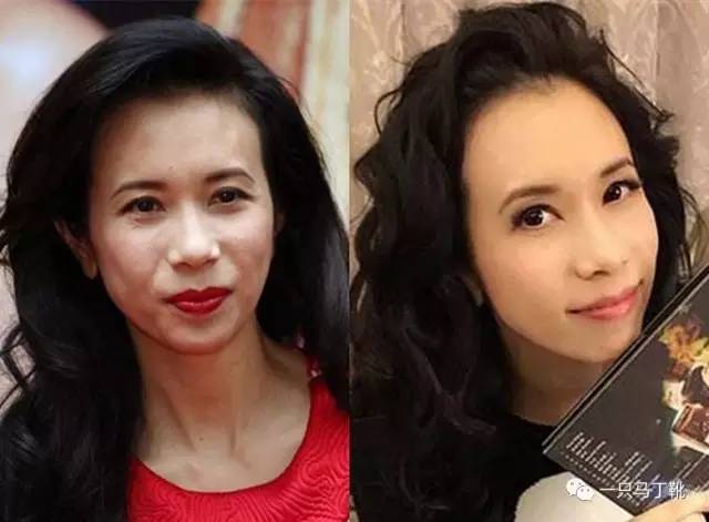 凸下巴凹面型脸怎么改变,脸宽但下巴尖怎么瘦下来