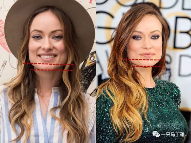 凸下巴凹面型脸怎么改变,脸宽但下巴尖怎么瘦下来