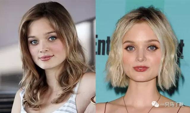 凸下巴凹面型脸怎么改变,脸宽但下巴尖怎么瘦下来