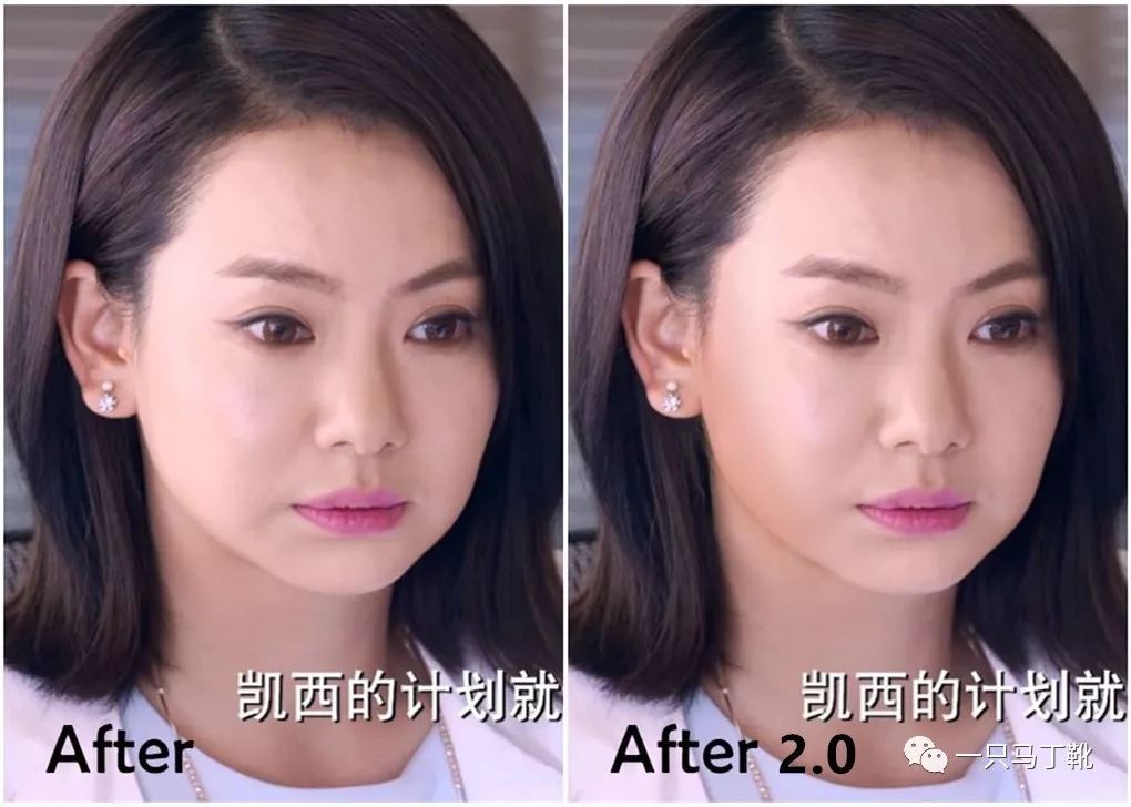 凸下巴凹面型脸怎么改变,脸宽但下巴尖怎么瘦下来