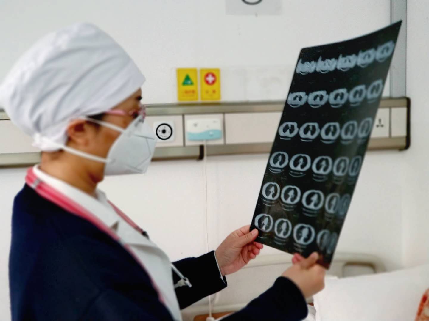 世界防治结核病传染途径,世界防治结核病最新消息