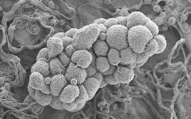 痛经但是月经量很少是什么原因,有痛经症状却无月经来是什么原因