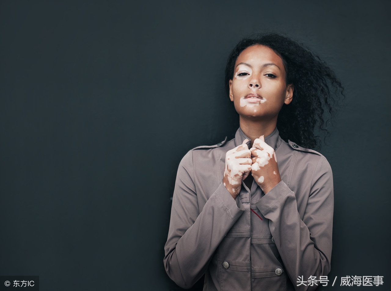 白癜风治疗新技术,白癜风激光疗法