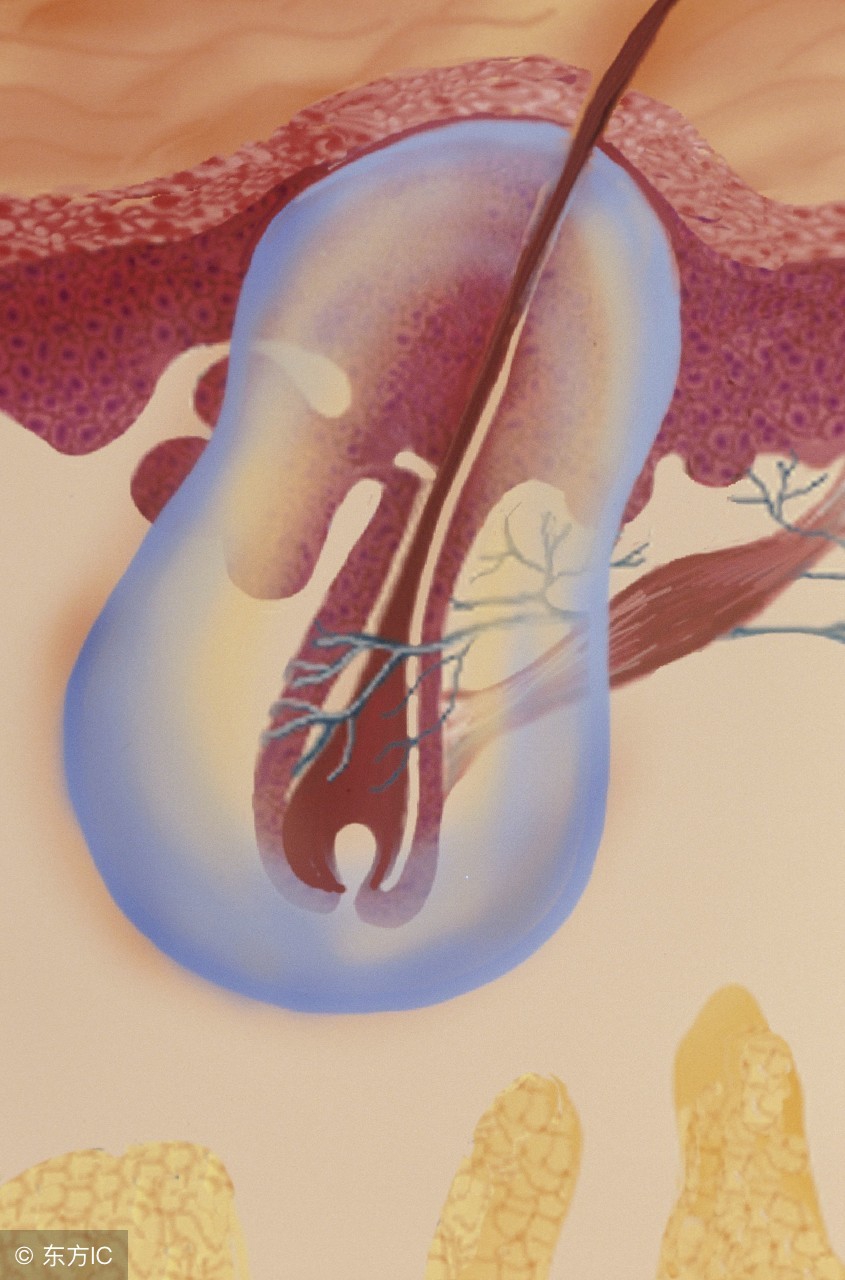 患了毛囊炎防治也是一个重要的环节