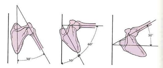 肩关节软组织损伤康复的最佳方法,打篮球肩峰撞击症最佳锻炼方法