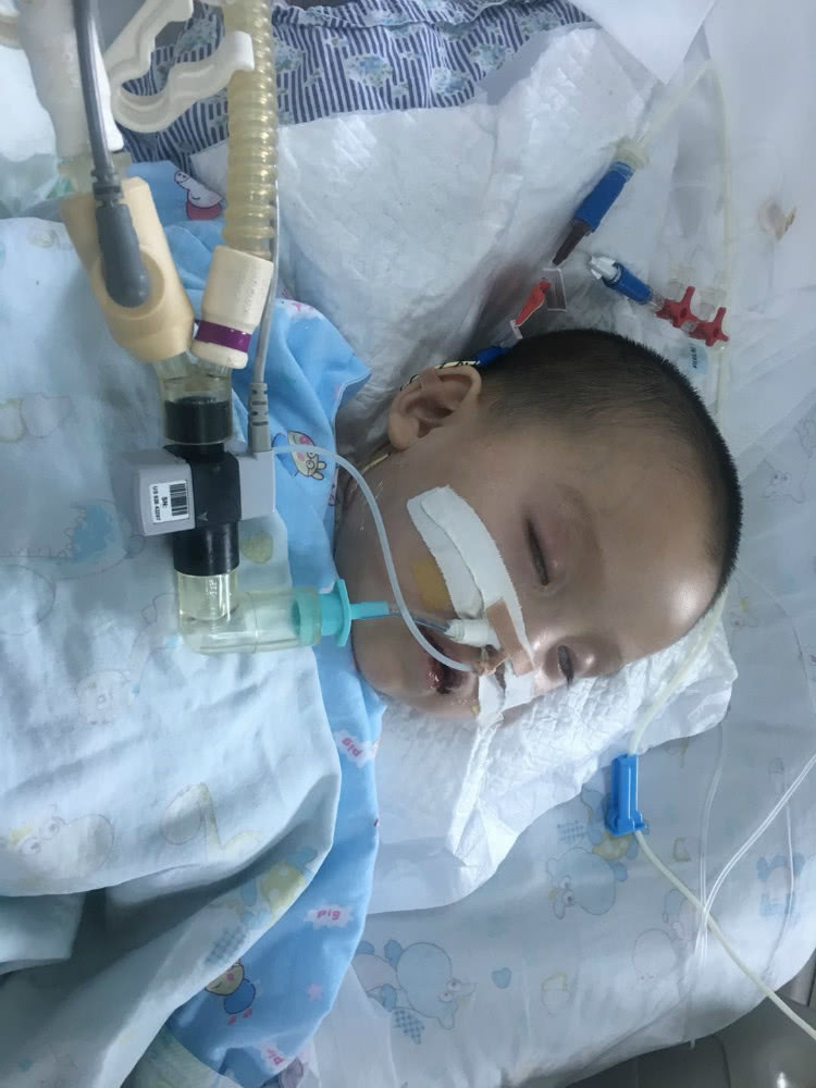 2岁萌童误食氢氧化钠导致中毒究竟是孩子的顽皮还是家长的疏忽