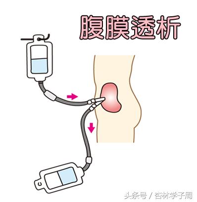 尿毒症引起的腿疼吃什么药,尿毒症腿痛