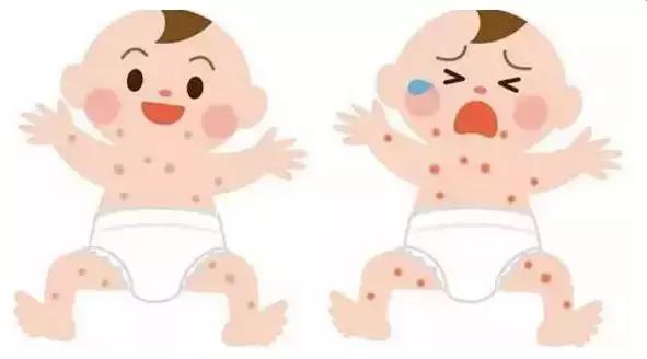 季节交替是湿疹高发期宝宝篇,春天为什么湿疹高发宝宝