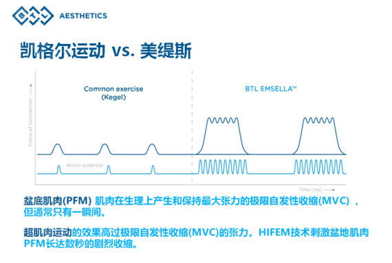 火遍香港台湾的“*福性**椅”BTLEMSELLA美缇斯到底是个什么设备？