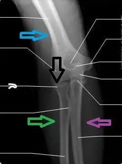 双排牙预防方法,预防孩子双排牙有什么方法