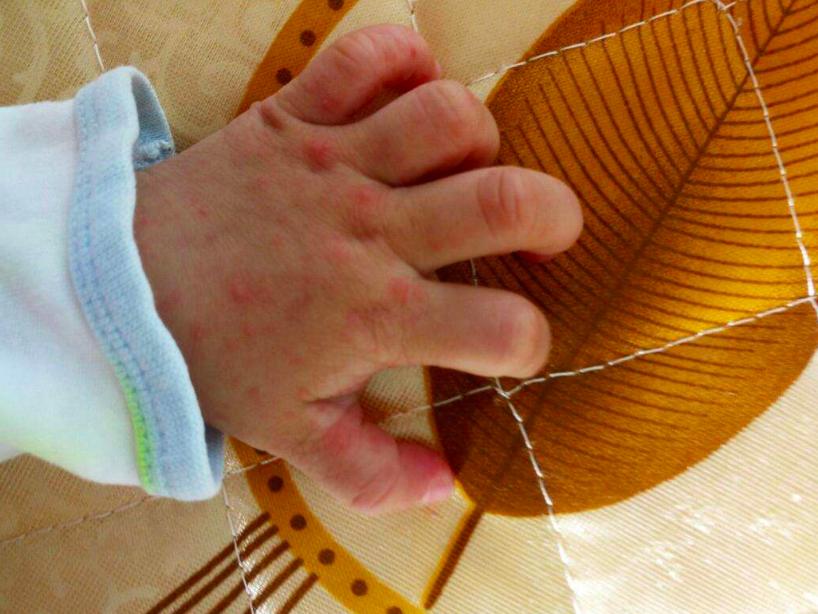 流感过后如何调养,流感来了怎样预防