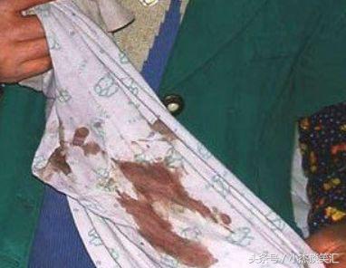 32岁女儿大口吐血妈妈崩溃,3岁女孩突然流了一点点鼻血