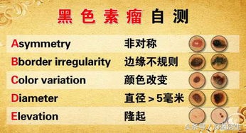 恶性黑色素瘤有活二十年的吗,恶性黑色素瘤为什么致死