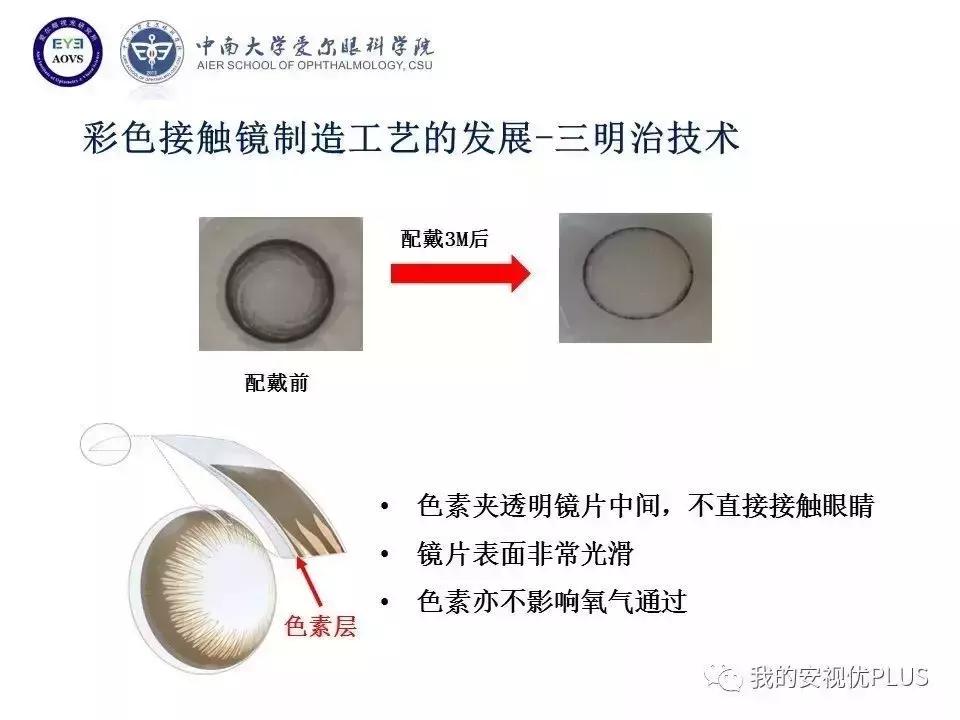 色弱色盲矫正隐形眼镜带度数的,爱尔眼科矫正视力隐形眼镜