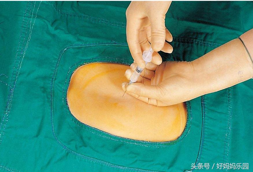 我想推广这项技术,请您支持,因为关系到你身边的她