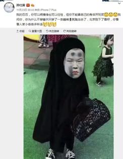 小岳岳去整形医院,小岳岳丑到什么程度