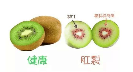 肛裂——最接近凌迟的酷刑