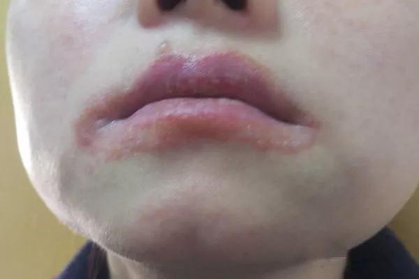 刚吃半个,男子竟差点送命!这种水果正大量上市,很多人爱吃!