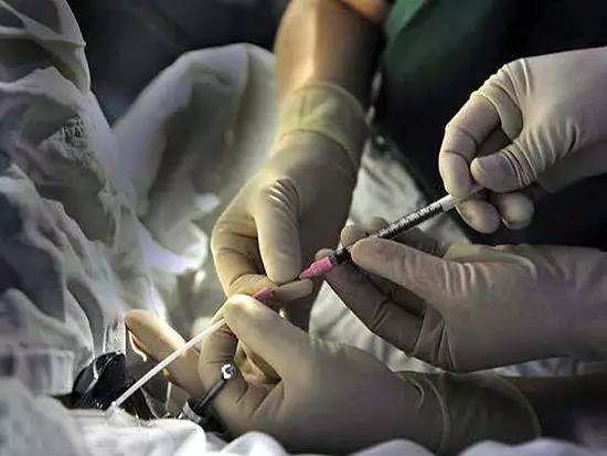 试管婴儿常识有哪些必须知道,试管婴儿需经历的六个阶段