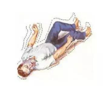 癫痫病的健康指导,春天癫痫病患者如何保养