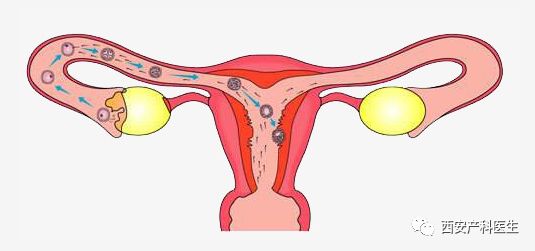 小俩口总是怀不上孩子，到底是谁的错？