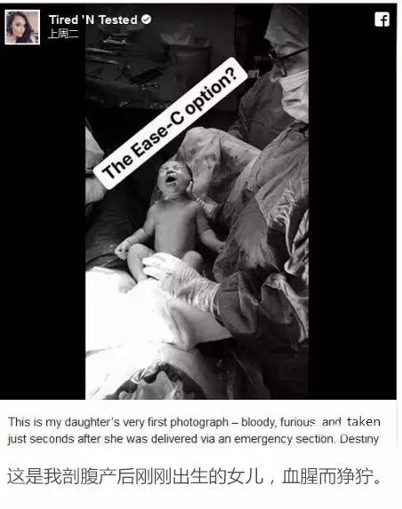 因为不是顺产的就被老公说没功劳，凭什么？都是用命换来的