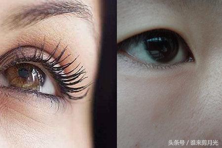 小孩眼角长脂肪粒怎么回事,眼角长脂肪粒怎么消除能用针挑吗