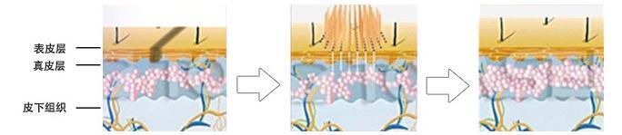 泰国纹眉技术如何,泰国女性纹眉失败案例