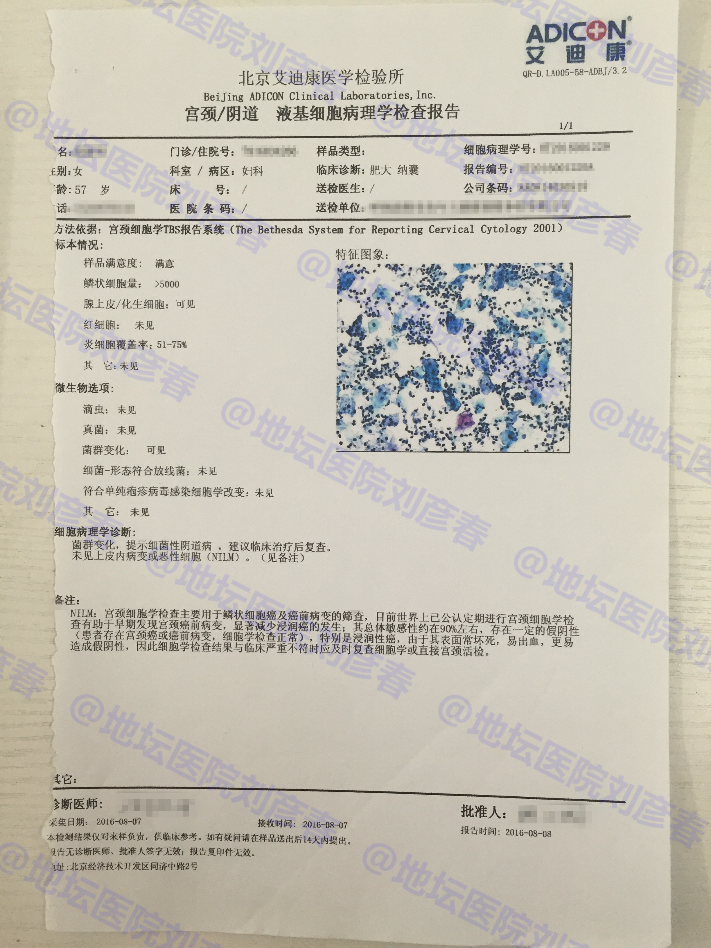 外阴痛看病经验分享,外阴痒腰骶骨疼