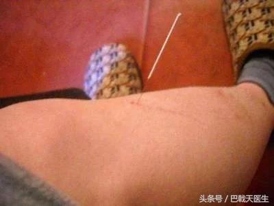 分享中医针灸基础知识，每日一穴：肚腹三里留