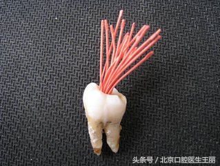 牙齿咬合疼痛一定要根管治疗吗,儿童牙齿根管治疗医保能报销吗