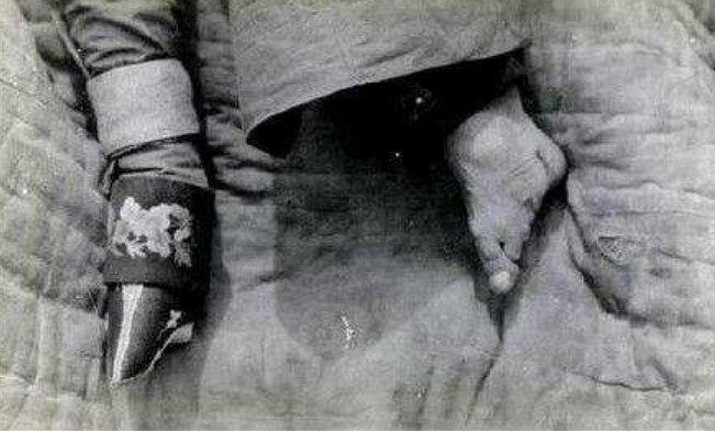 古代女子裹脚是从什么时候开始,中国裹脚历史的由来