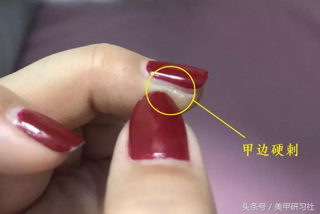 美甲指甲老是从侧边断了,美甲指甲分层原因和处理方法