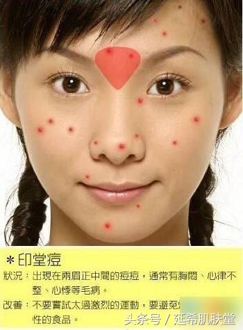 下巴不停冒脓包型痘痘怎么样调理,下巴长满痘痘是什么原因怎么调理