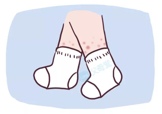 全身大面积虫咬性皮炎,新生儿虫咬皮炎越长越多怎么办