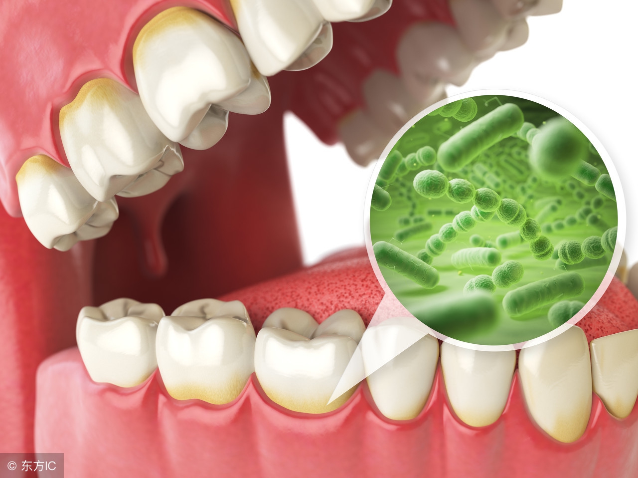 家长口臭对婴儿的影响,家长有胃病孩子会遗传吗