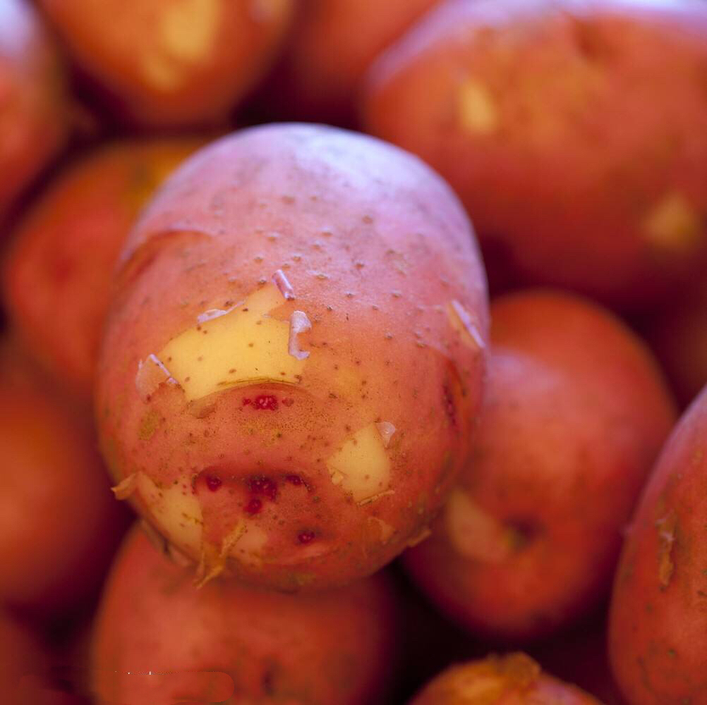 痔疮如何预防和治愈,热水熏蒸治痔疮是最大的误区