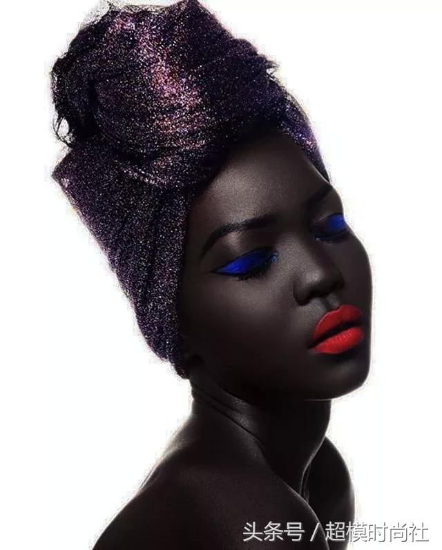 她连牙龈都是乌黑的!但她却敢反歧视,活成INS大热的模特女王