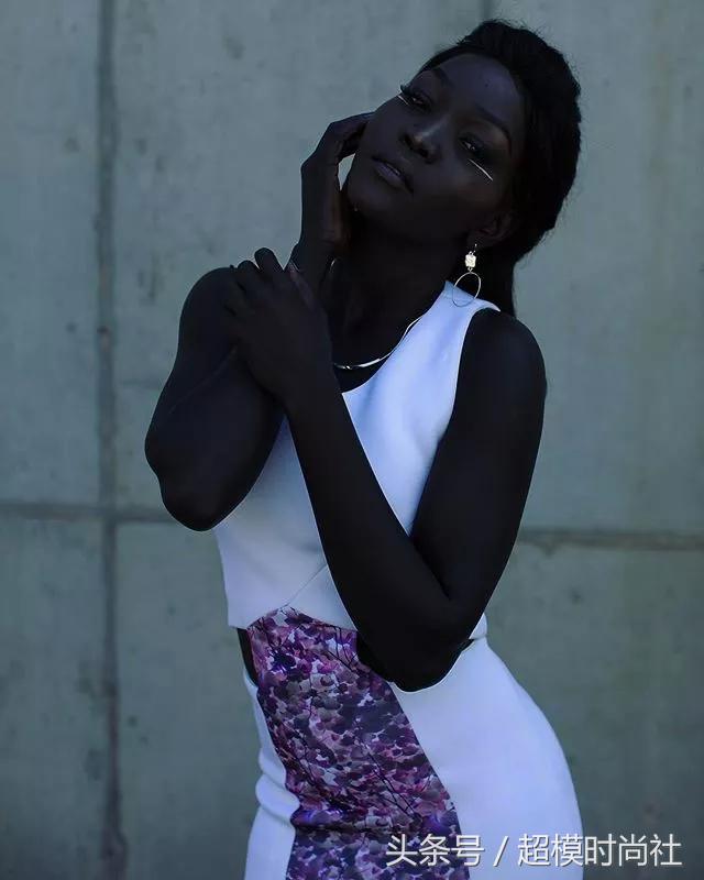 她连牙龈都是乌黑的!但她却敢反歧视,活成INS大热的模特女王