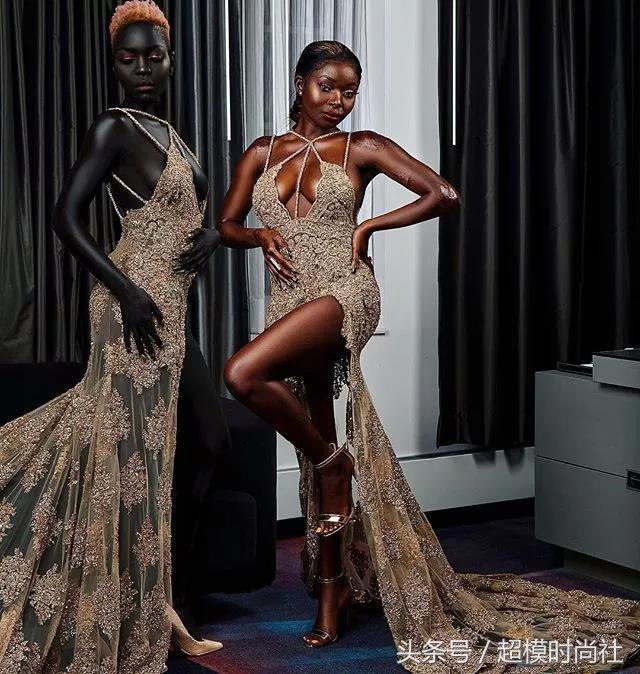 她连牙龈都是乌黑的!但她却敢反歧视,活成INS大热的模特女王