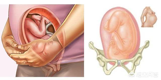 37周还没入骨盆怎么办,37周后骨盆开多少