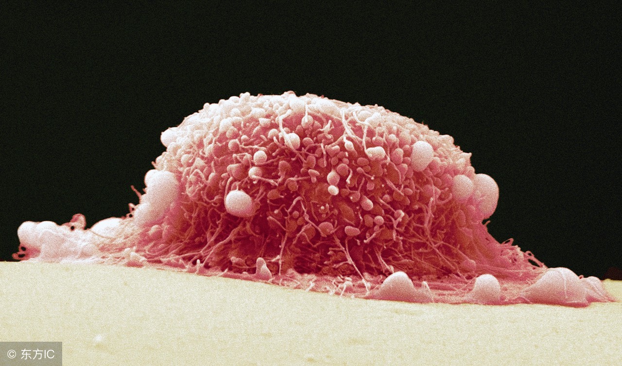 子宫肌瘤能引起腰疼,子宫肌瘤会引起腰疼和出血吗