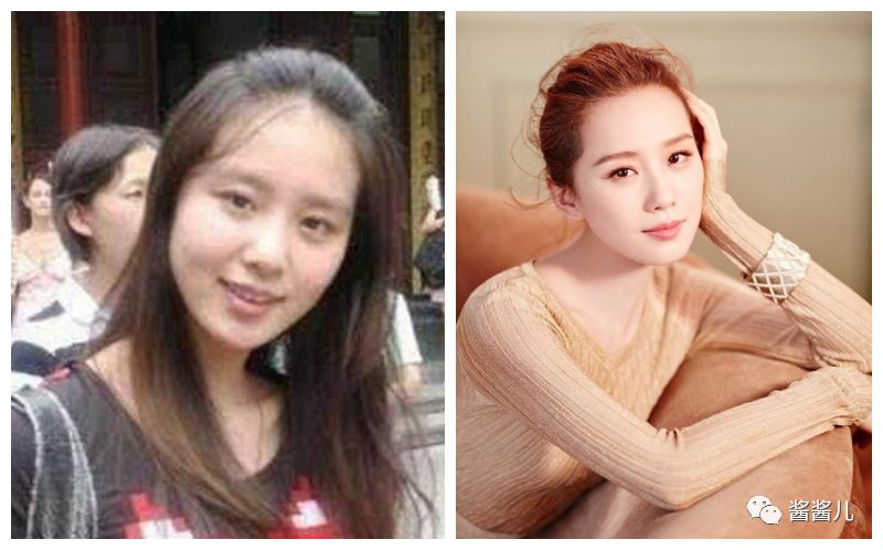 祛水肿护肤仪,护肤瘦脸神器