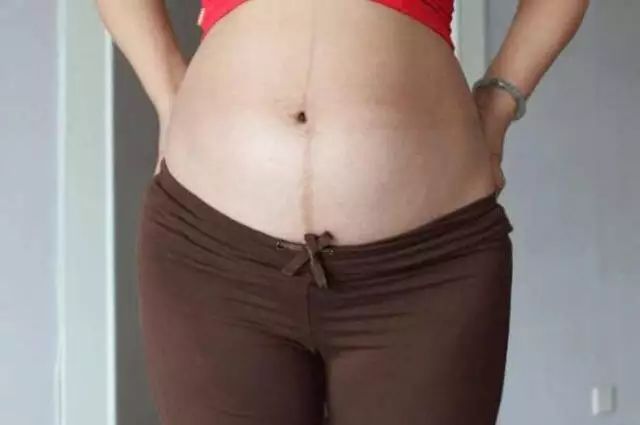 孕妈妈皮肤黑吃什么宝宝会变白,孕妈妈身体变黑说说