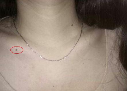 什么样的痣在身体上是吉痣,身上有三种痣是富贵痣