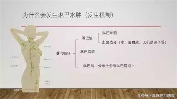 乳腺癌术后淋巴水肿预防和治疗ppt,乳腺癌术后淋巴水肿的护理论文