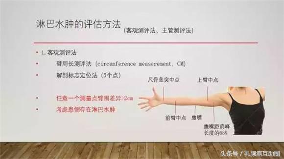 乳腺癌术后淋巴水肿预防和治疗ppt,乳腺癌术后淋巴水肿的护理论文