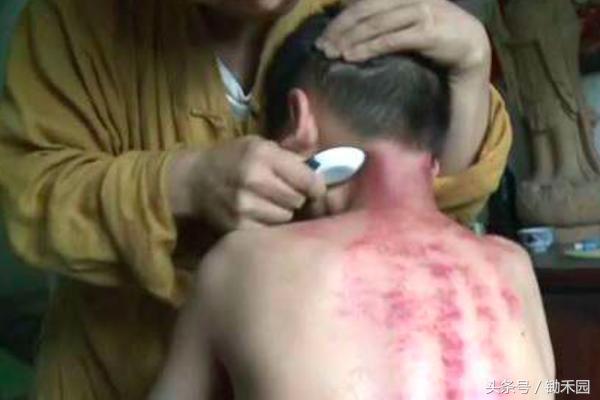 农村大妈偏方大全,一招解决上火的小偏方