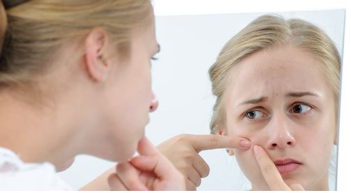 别再随便挤痘痘,别再挤痘痘了医生教你科学战痘