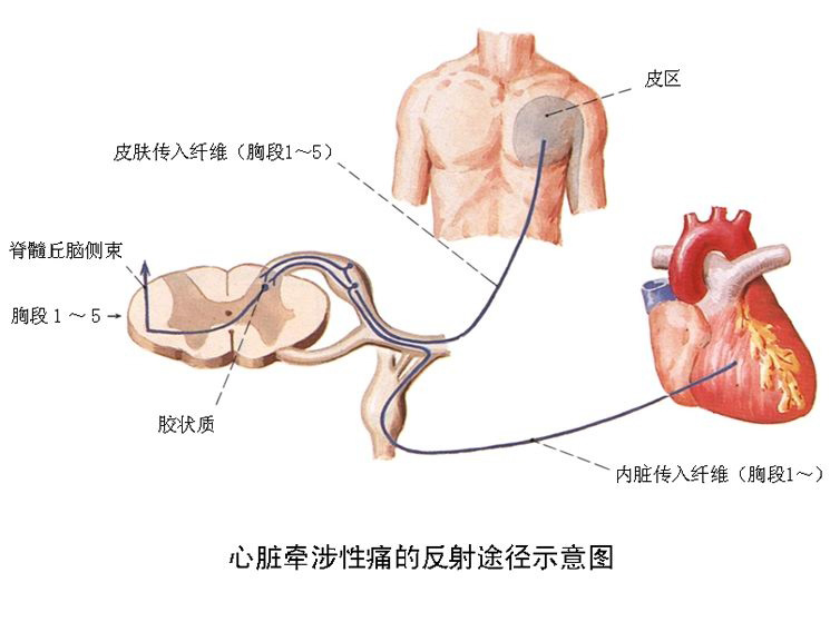 饭后心口疼后背疼怎么办,饭后胸口后背隐隐作痛